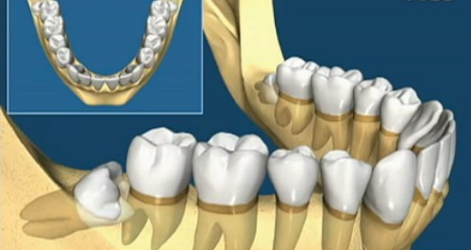 智慧齿