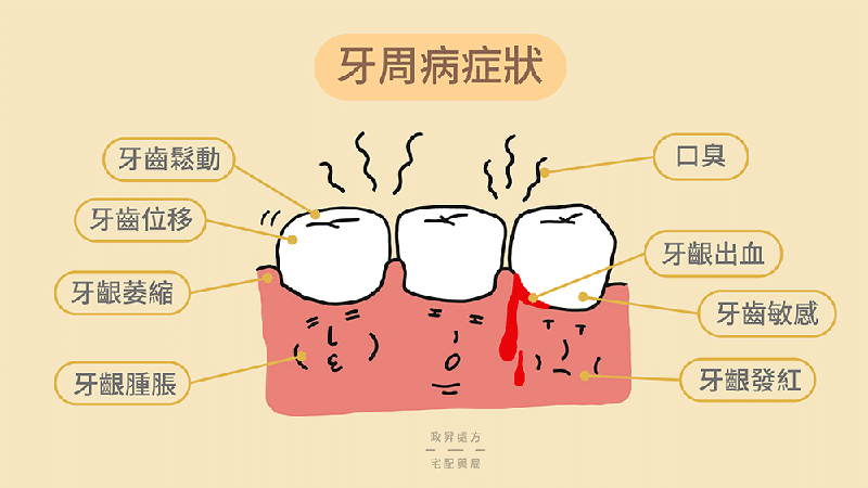 牙周病